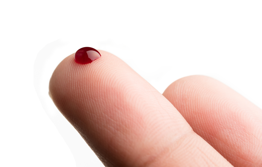 Emofobia: cos’è la paura del sangue e come affrontarla