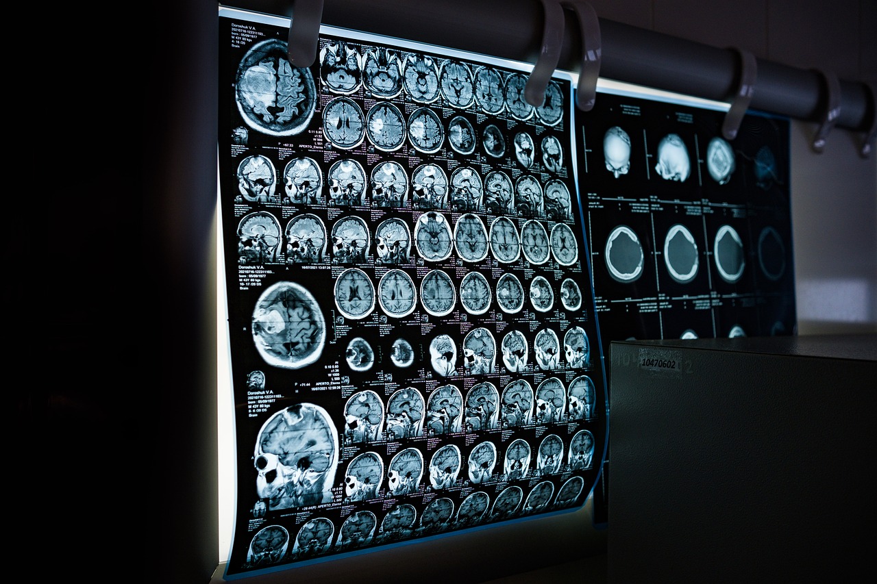 Cancerofobia: affrontare la paura del cancro con consapevolezza