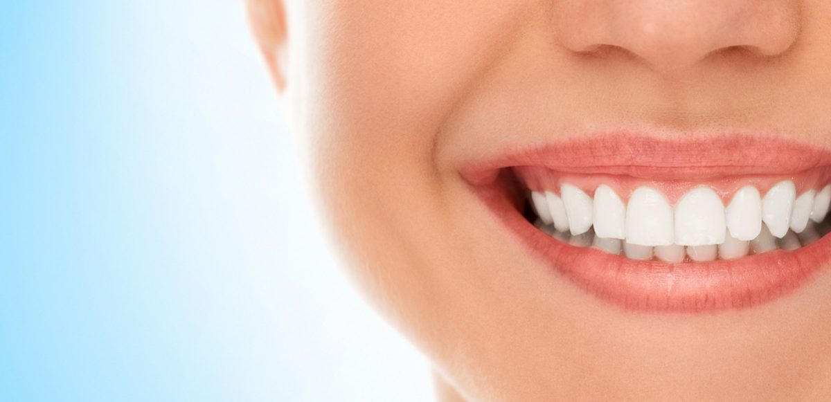 donna sorride cibi che macchiano i denti