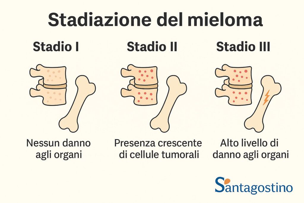 stadiazione mieloma