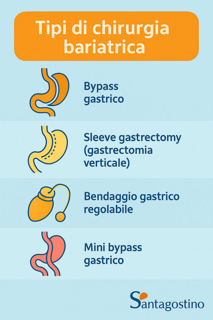 chirurgia bariatrica, principali tipi di intervento