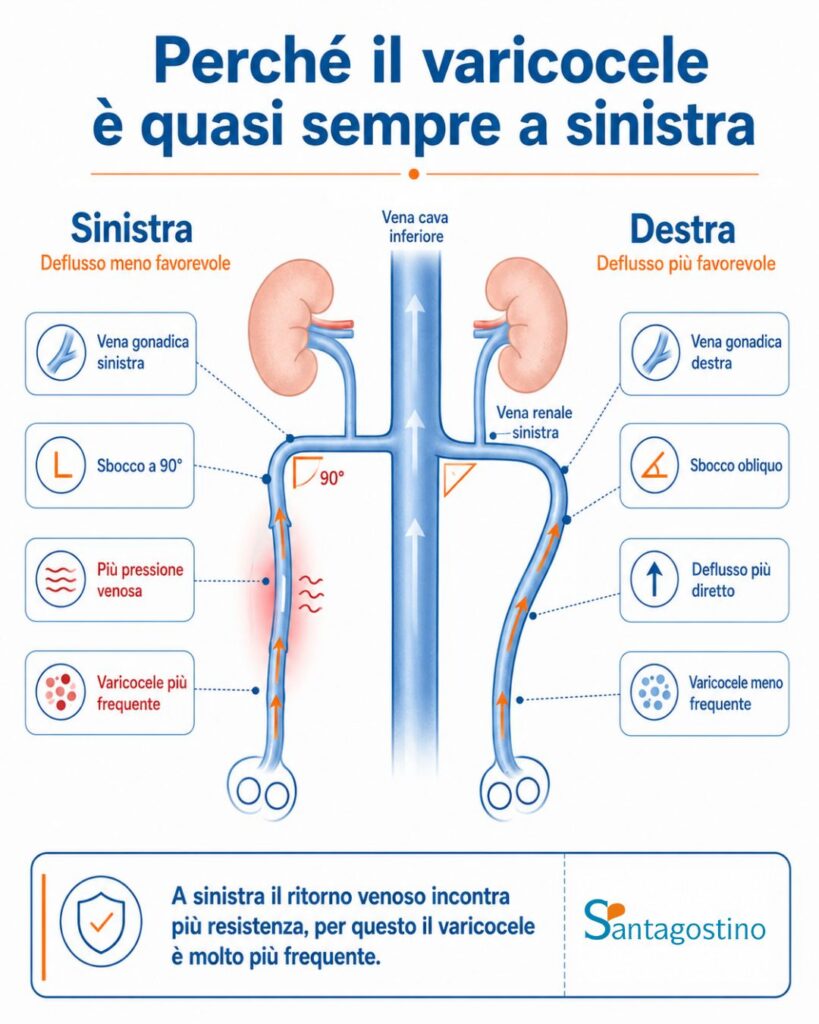 Perché il varicocele colpisce a sinistra