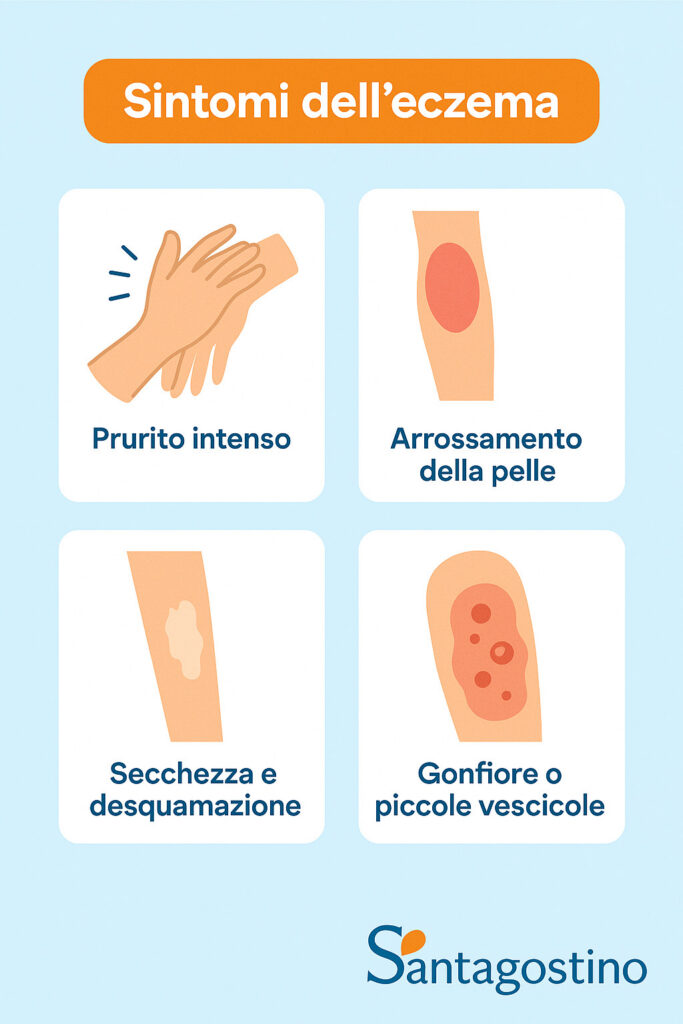 sintomi eczema, quali sono