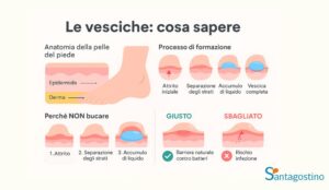 cause delle vesciche ai piedi