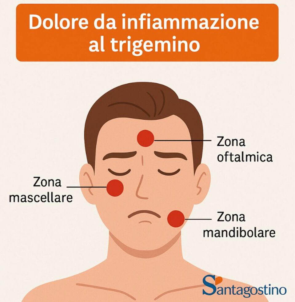infiammazione trigemino, dove fa male