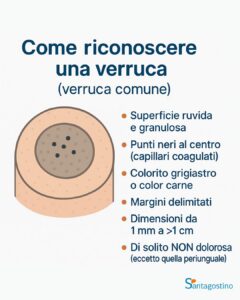 come riconoscere verruca