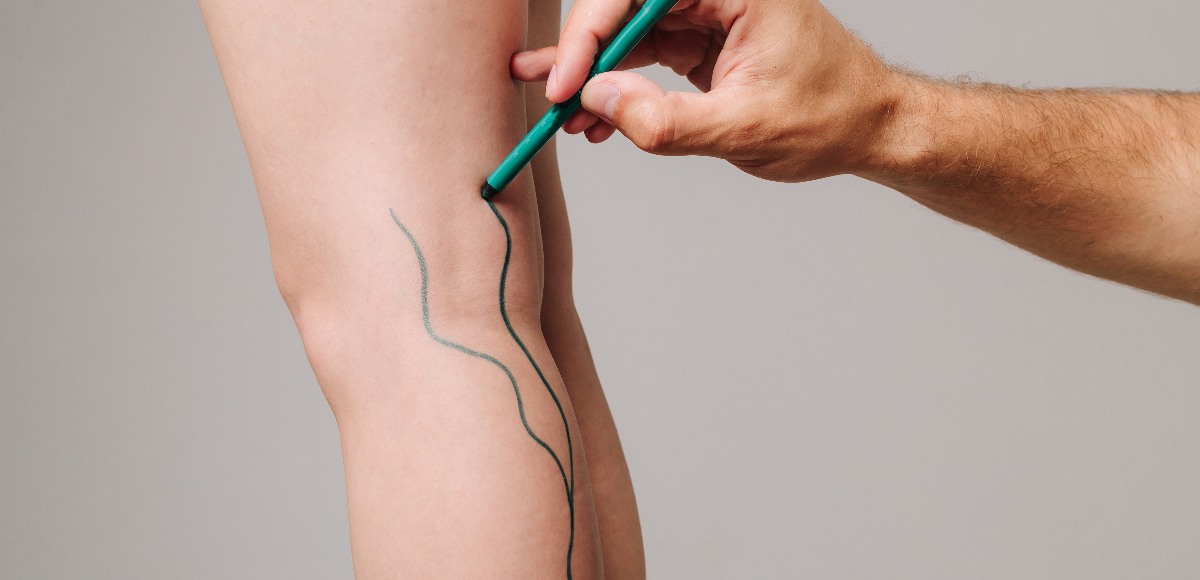 integratori circolazione