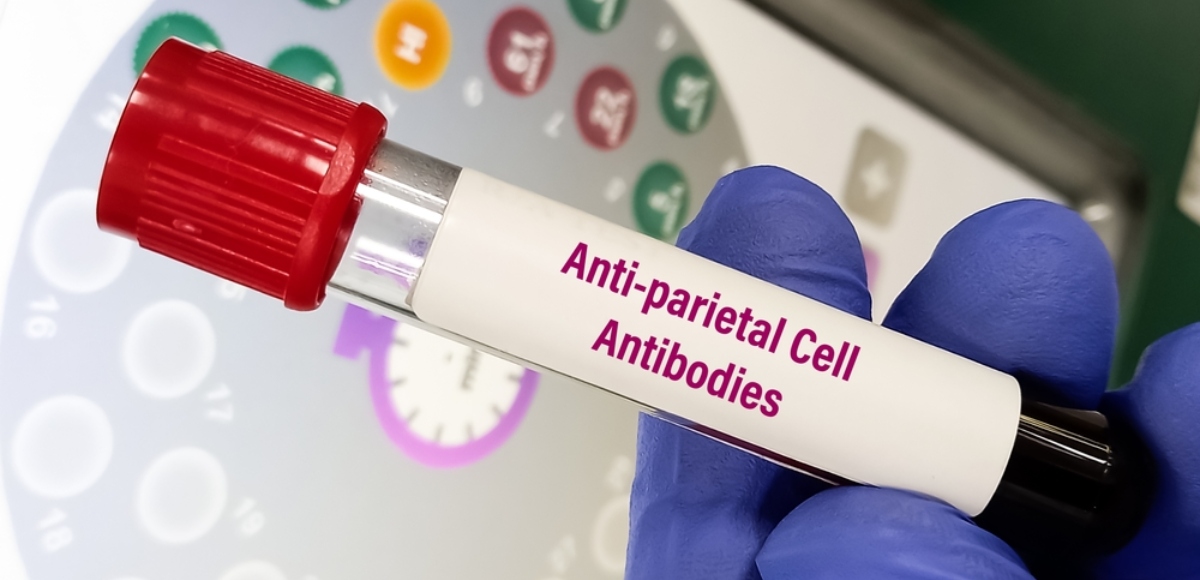 APCA (Anticorpi Anti-Cellule Parietali)