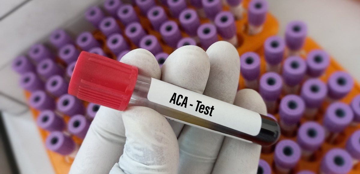 anticorpi anti mitocondri