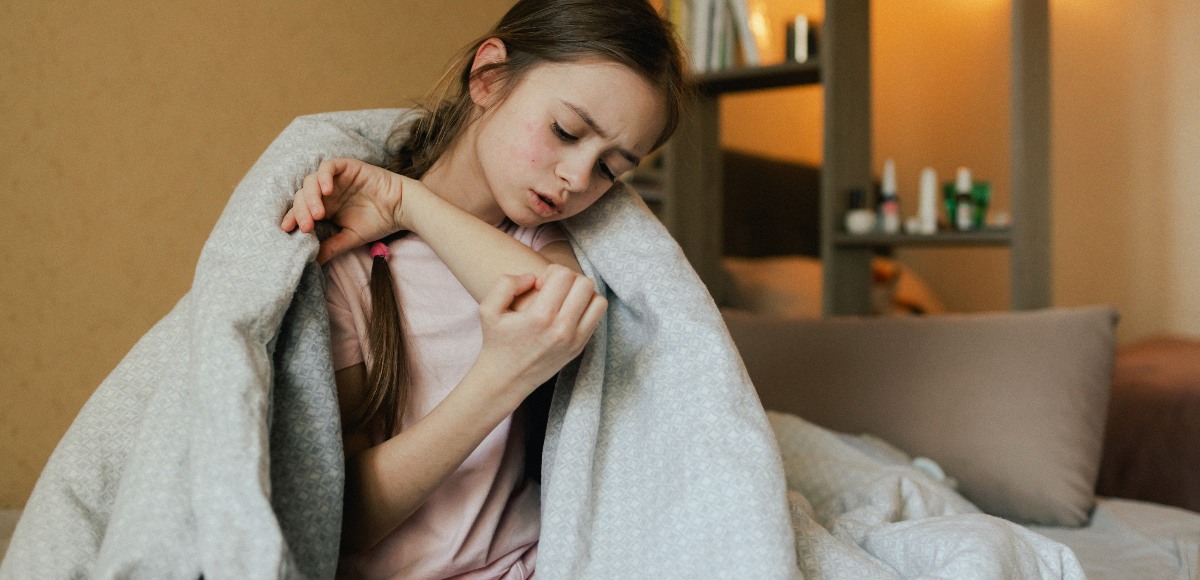 orticaria-cronica-spontanea