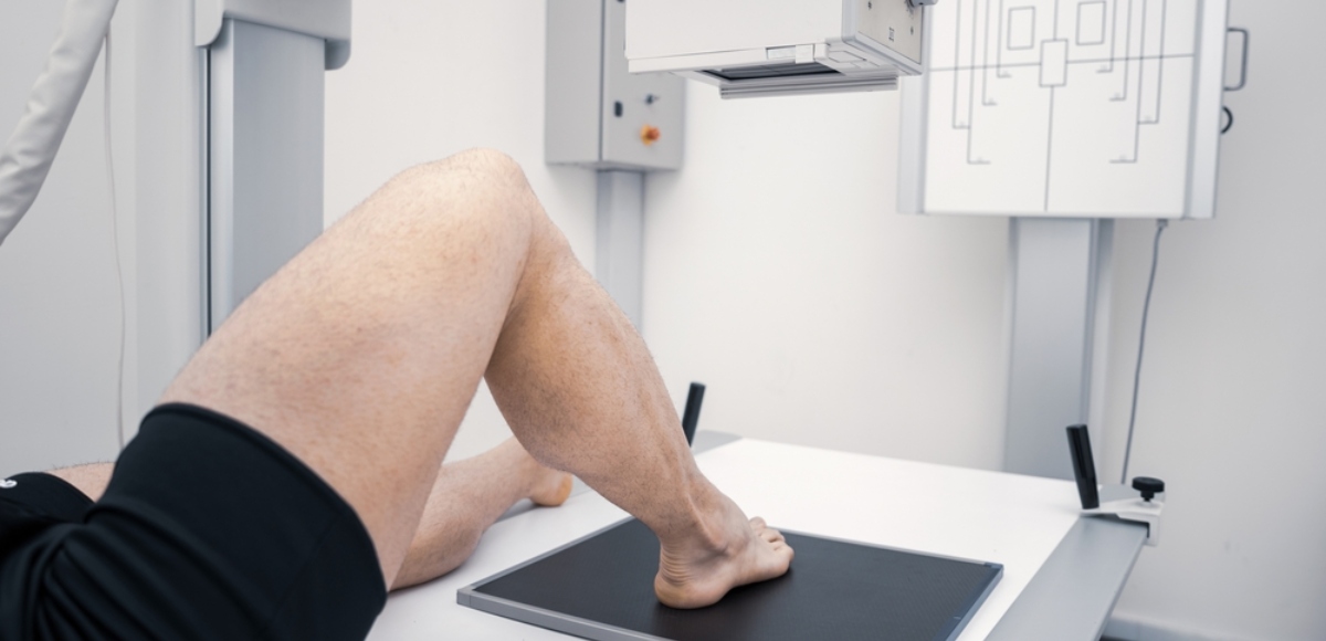 radiografia calcagno